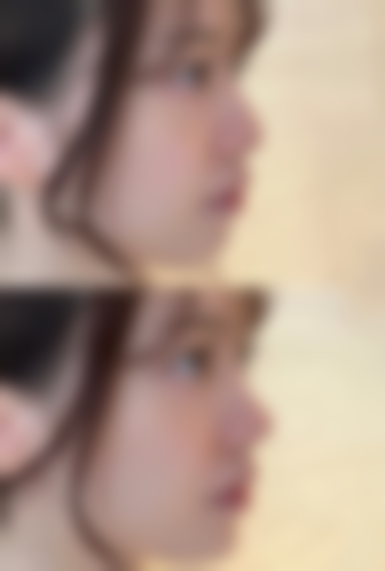 二、王国权医生擅长项目