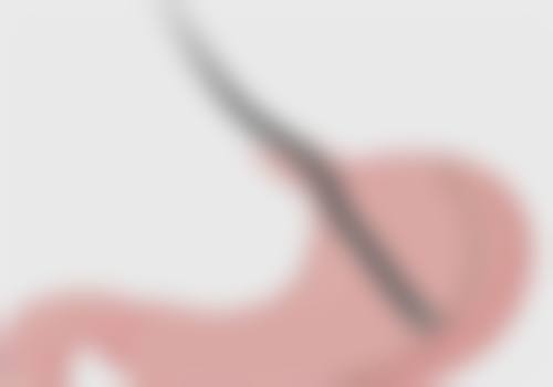 四、黄慧玲医生口碑评价好