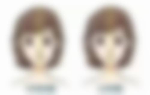 广州广美整形美容医院黄慧玲主治医师