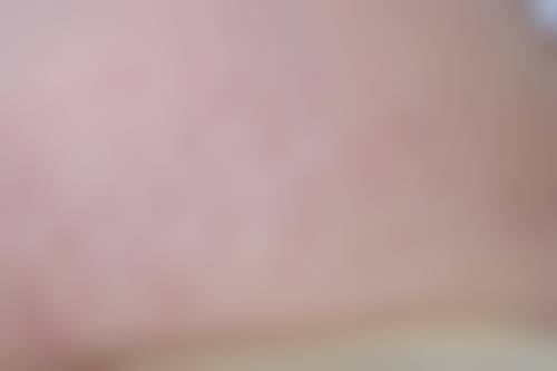 6、太原美之妍整形美容门诊口碑好评反馈