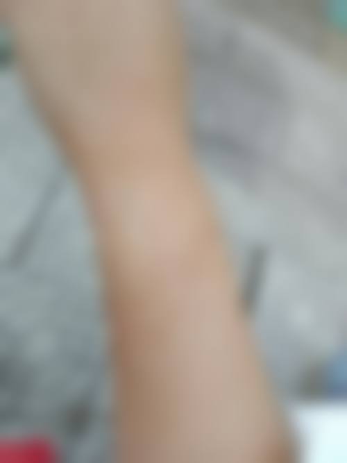 城市开福区美研医疗美容门诊部患者常见问题解答（精选 ）