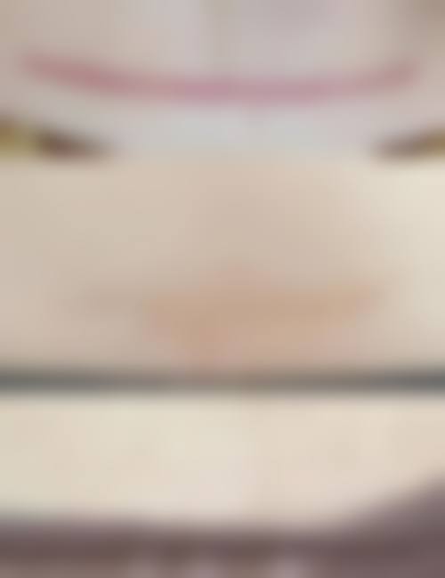 三、超皮秒picoway和picosure什么区别