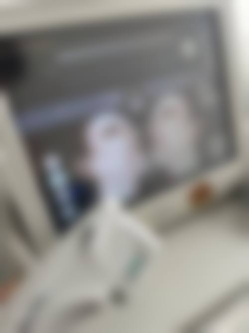 {picoway超皮秒是美国还是以色列？揭秘美国原装进口真相，祛斑效果实测惊艳！