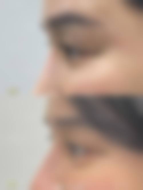 三、侯智群医生技术水平高