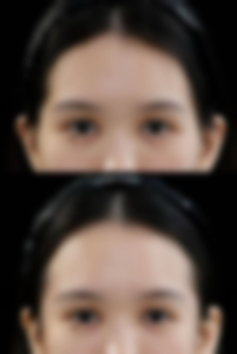 五、黄慧玲医生怎么预约挂号