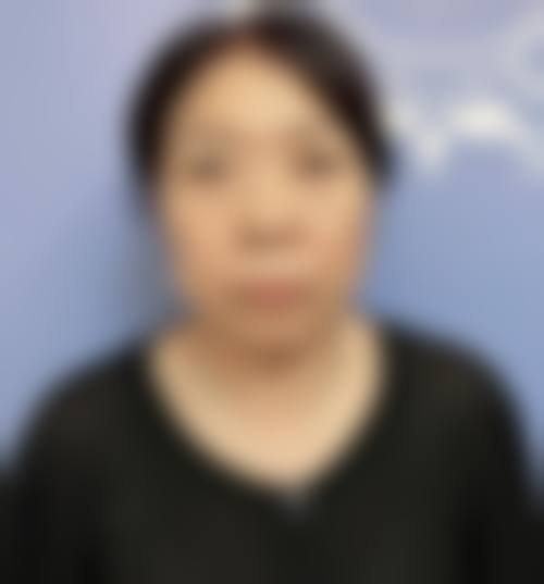 二、怎样用茶叶去掉眼袋更有效