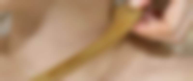 2、【激光美容】核心技术优势