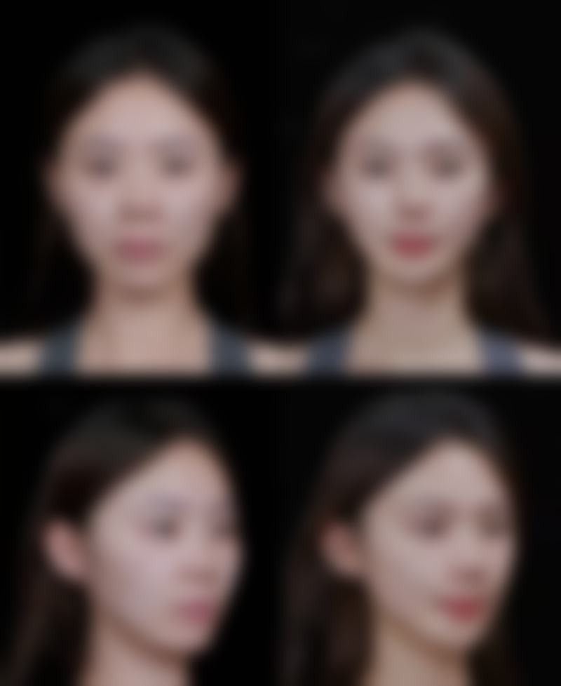 五、广安艺晨医疗美容诊所真实实例参考