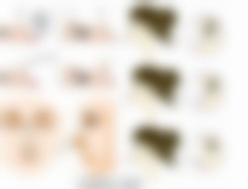 二、吴文育医生擅长项目