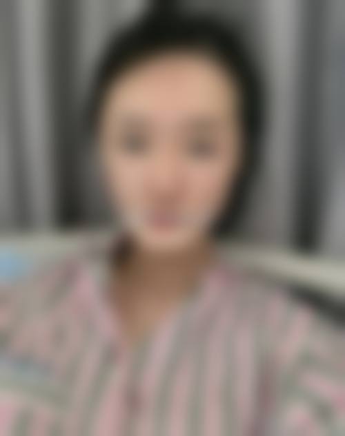 六、宜昌瑞茗医疗美容门诊部精细化眼部综合整形技术优势