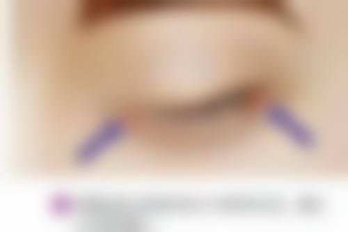 三、宇部Medical诊所开展项目及特色技术