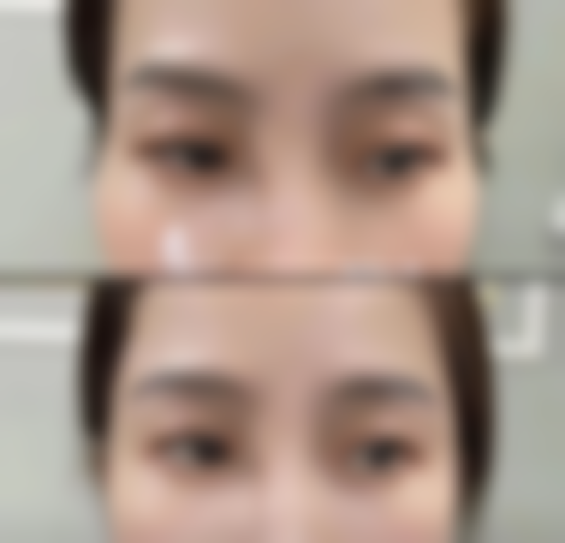 三、伍新鹏医生做手术价格：