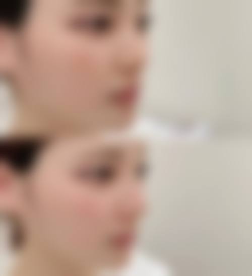 九、李正根医生患者常见就诊关注点说明