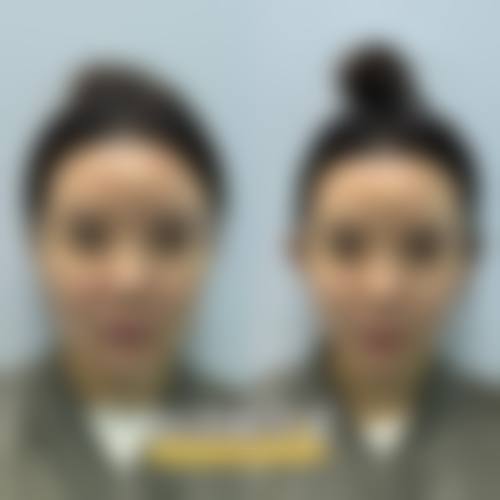 5、解放军81医院美容整形科口碑好评反馈