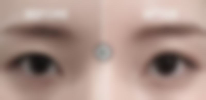 三、做完全切双眼皮手术后的忌口清单