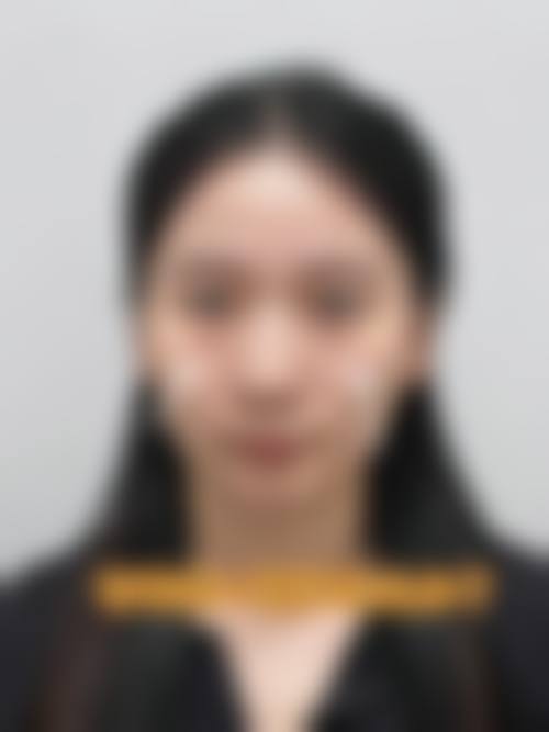 肿胀期超 2 周正常吗?