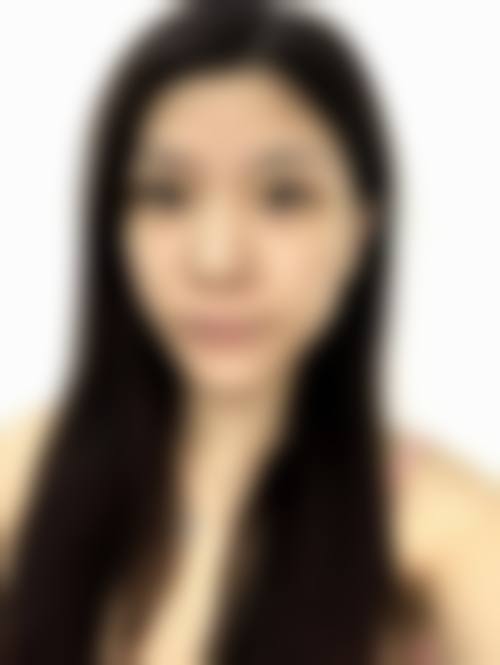 为什么脂肪存活率不足 30%?