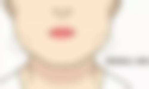 七、患者常见问题解答（精选 ）