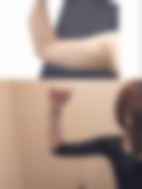 五、手臂抽脂至佳成效显现时间