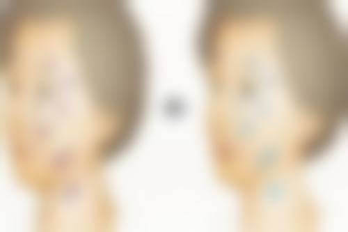 黄慧玲医生擅长项目