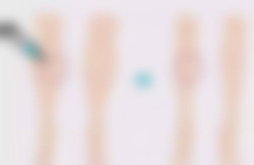 Soleil Clinic 江戸川桥皮肤美容技术优势