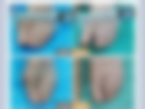 Soleil Clinic 江戸川桥价格表