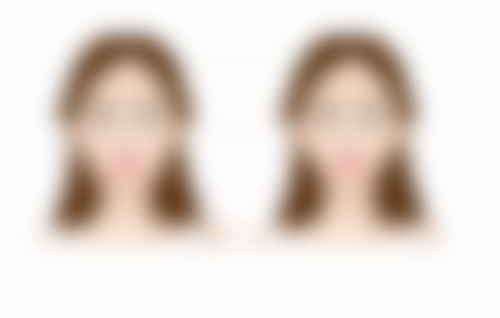 黄慧玲医生手术成效