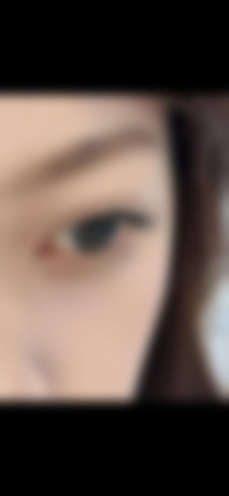 珠海雍禾植发医疗美容诊所患者常见问题解答（精选 ）