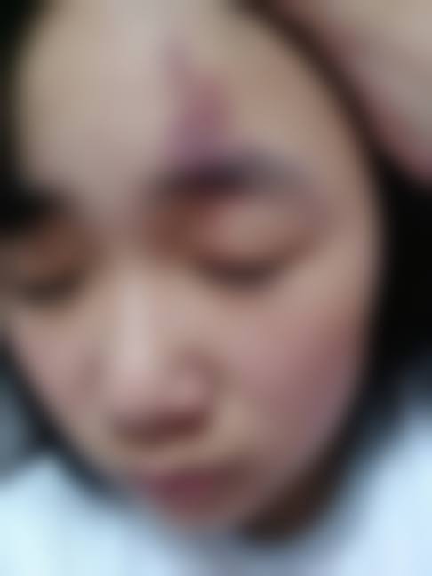 五、佛山幻都荣恩医疗美容医院真实实例参考