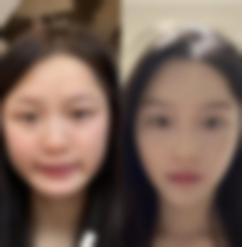 黄慧玲医生口碑评价