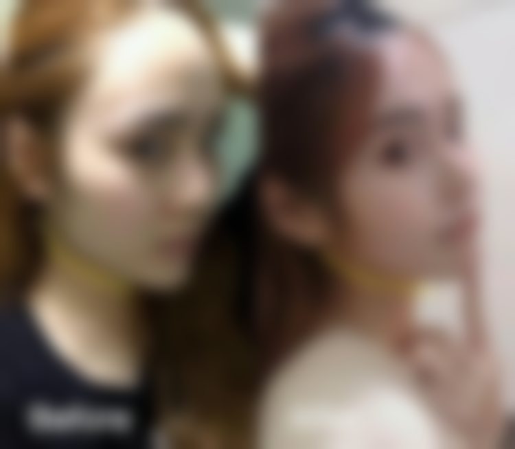 3. 私密面诊太戳心：专属方案里藏着专精细节