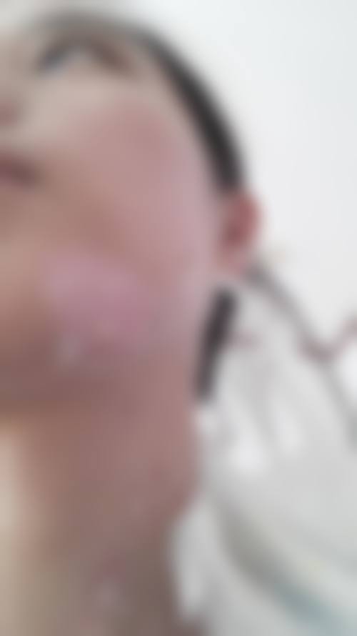 八、患者常见问题解答（精选 ）