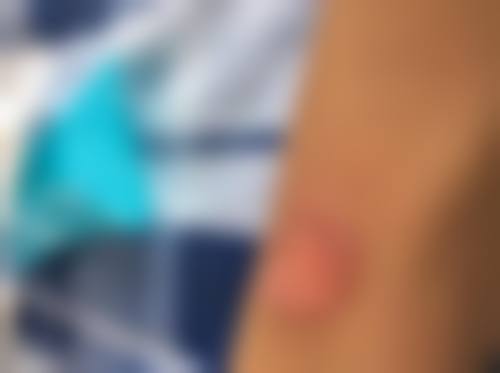 十一、呼和浩特伊思整形专科医院地址电话