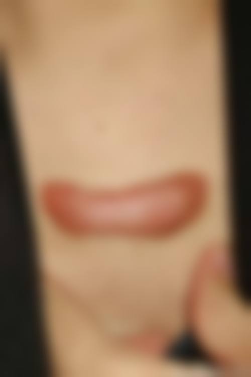 八、如何选择治疗疤痕增生的医院和医生