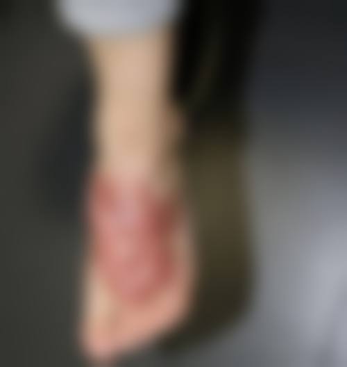 5、北京壹可唯整形医院口碑好评反馈