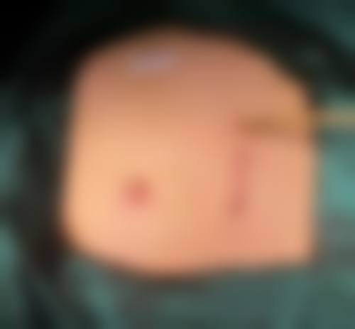 临沂咖美整形医疗美容医院患者常见问题解答（精选）