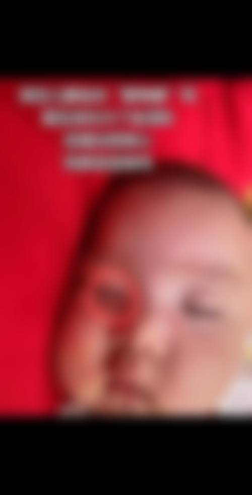 临沂咖美整形医疗美容医院正规可靠吗？