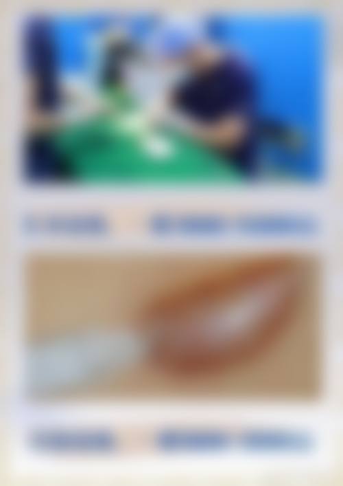 {疤痕增生越来越大怎么办？3招止痒消硬块，疤痕增生变好的症状全解析！