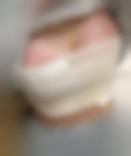 七、隆胸医院医生如何选择