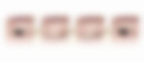 五、成都崇州汉密尔顿美容医院收费价格表/收费标准