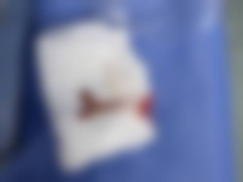 四、患者参考信息