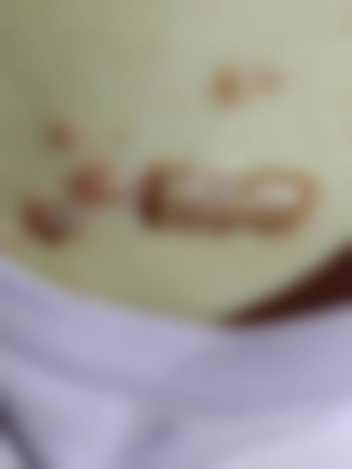 西安春禾医疗美容医院患者常见问题解答（精选 ）