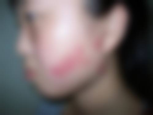 临沂星塑美医疗美容医院患者常见问题解答（精选 ）