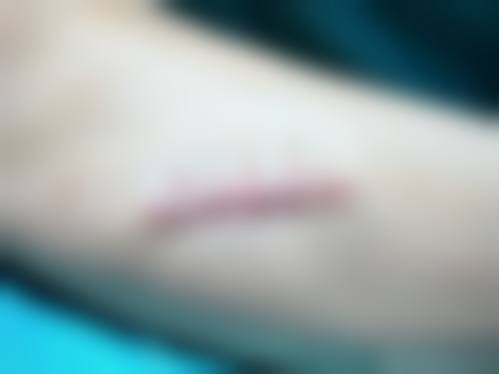 西安春禾医疗美容医院温馨提示——为了节省您的时间，看诊前请预约哦！