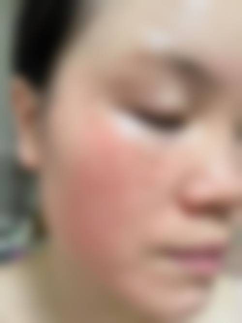 八、患者常见问题解答（精选 ）