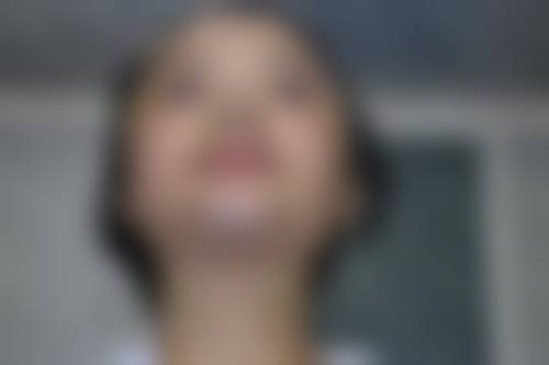 （4）口角上扬、注射微整医生