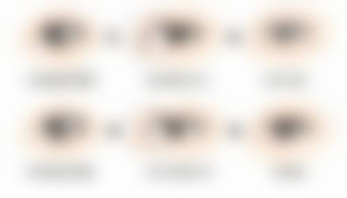 {全切双眼皮太深了会变浅吗？术后3-6个月可改善，教你深了怎么办、能否改浅