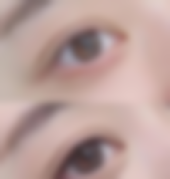 二、张小红医生擅长项目