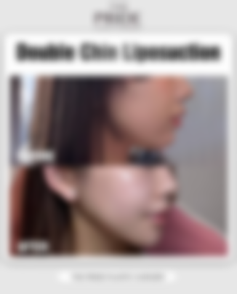 三、谢文斌医生技术水平高