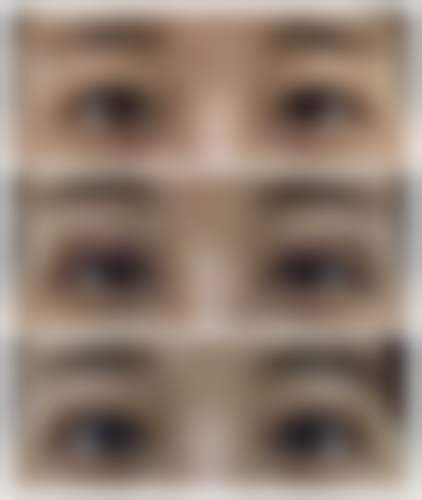 八、患者常见问题解答(精选 )